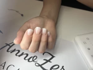 onicofagica onicofagica